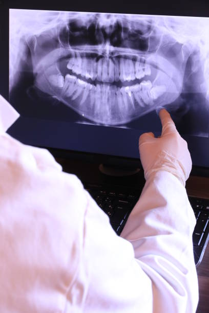 Best Broken or Chipped Tooth Repair in Mars, PA